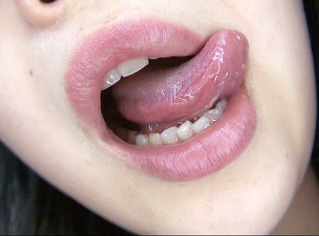 100人のおくち 第9集