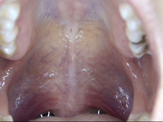 100人のおくち 第3集