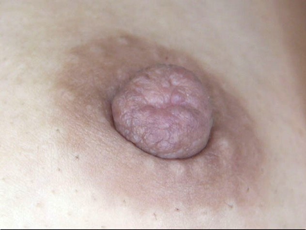 100人の乳首 第6集