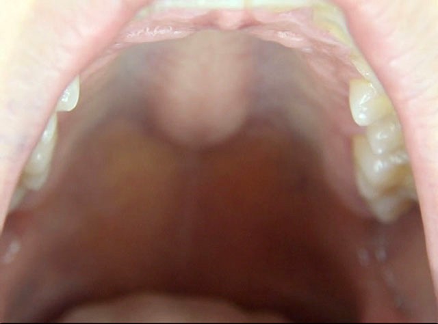 100人のおくち 第4集
