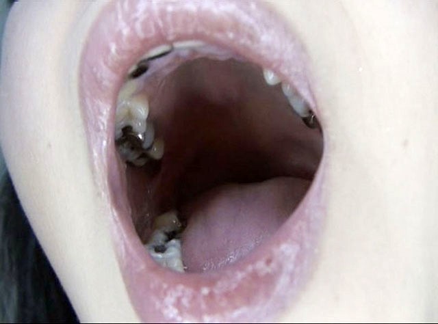 100人のおくち 第6集